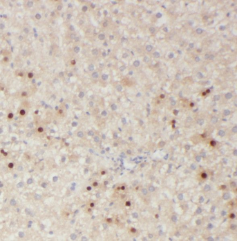 RNASE11 Rabbit Polyclonal Antibody