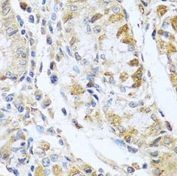 RNASE13 Rabbit Polyclonal Antibody
