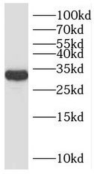 RNASEH1 Antibody