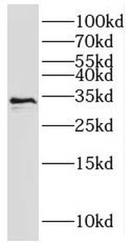 RNASEH2A Antibody