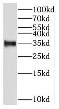 RNASEH2B Antibody