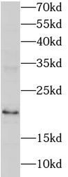RNASEH2C Rabbit Polyclonal Antibody