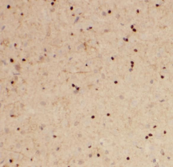 RNASEH2C Rabbit Polyclonal Antibody