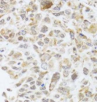 RNASEL Rabbit Polyclonal Antibody