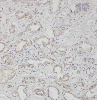 RND2 Rabbit Polyclonal Antibody