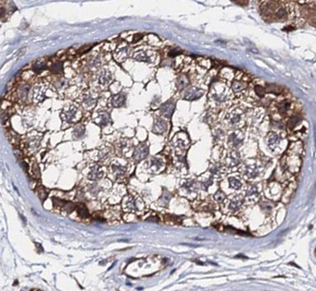 RNF133 Rabbit Polyclonal Antibody