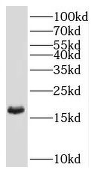 RNF181 Antibody