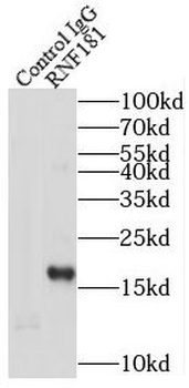 RNF181 Rabbit Polyclonal Antibody