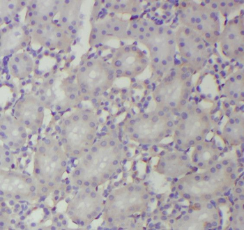 RNF181 Rabbit Polyclonal Antibody