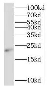 RNF212 Antibody