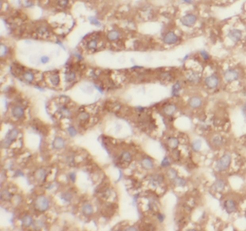 MRM3 Rabbit Polyclonal Antibody