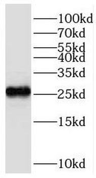 ROPN1L Antibody