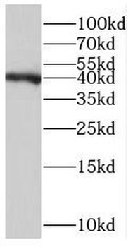 RP2 Rabbit Polyclonal Antibody
