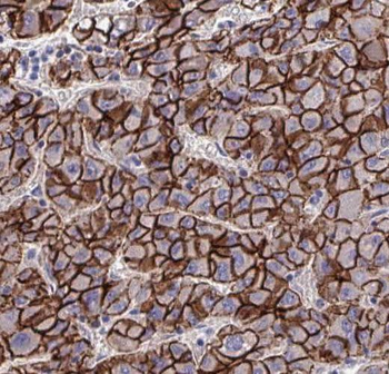 RP2 Rabbit Polyclonal Antibody