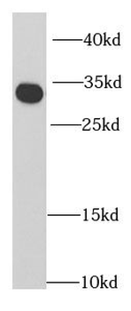 RPA2 Rabbit Polyclonal Antibody