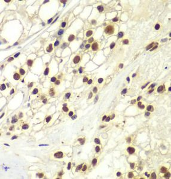 RPA2 Rabbit Polyclonal Antibody