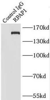 RPAP1 Rabbit Polyclonal Antibody