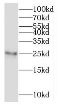 RPL10A Antibody