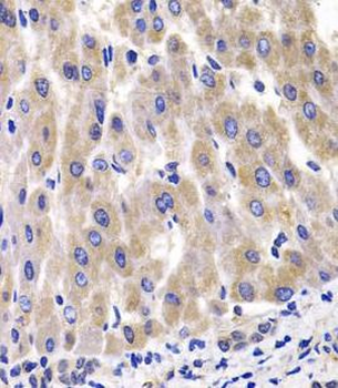 RPL14 Rabbit Polyclonal Antibody