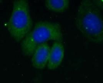 RPL18A Rabbit Polyclonal Antibody