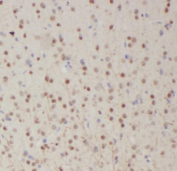 RPL19 Rabbit Polyclonal Antibody