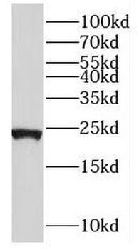 RPL21 Rabbit Polyclonal Antibody