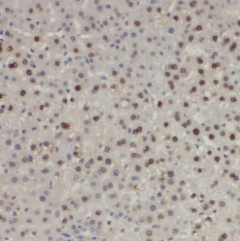 RPL21 Rabbit Polyclonal Antibody
