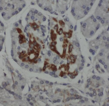 RPL38 Rabbit Polyclonal Antibody
