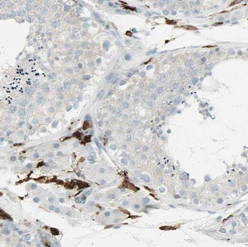 RPL39L Rabbit Polyclonal Antibody