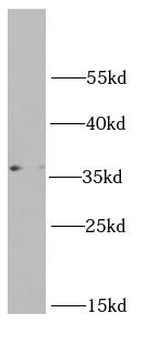 RPL5 Rabbit Polyclonal Antibody