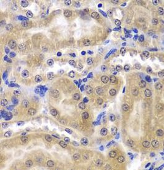 RPL5 Rabbit Polyclonal Antibody