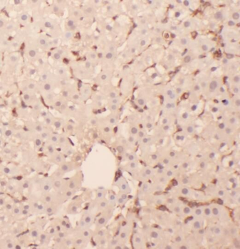 RPL6 Rabbit Polyclonal Antibody