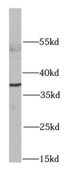 RPLP0 Antibody
