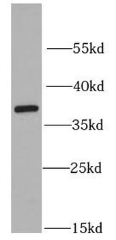 RPLP0 Antibody