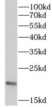 RPP21 Antibody