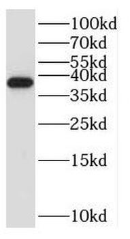 RPP38 Antibody