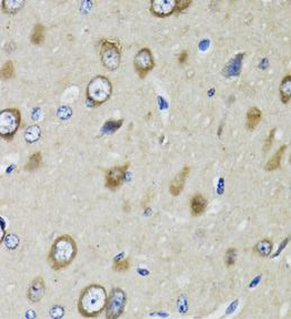 RPS10 Rabbit Polyclonal Antibody