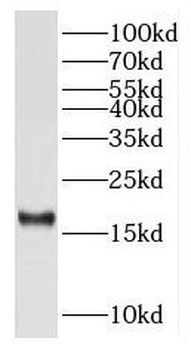 RPS15 Antibody