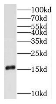 RPS16 Antibody