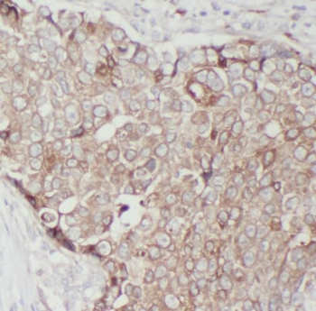 RPS16 Rabbit Polyclonal Antibody