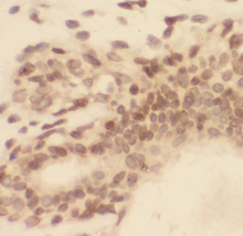 RPS19 Rabbit Polyclonal Antibody