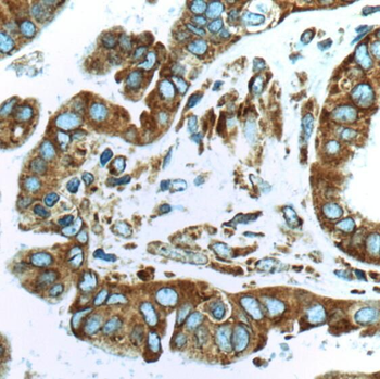RPS29 Rabbit Polyclonal Antibody
