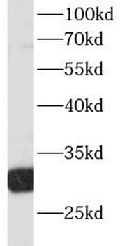 RPS3 Antibody