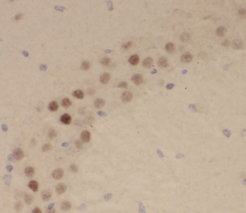 RRAGB Rabbit Polyclonal Antibody
