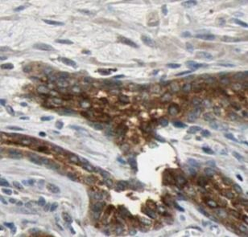 RRAS Rabbit Polyclonal Antibody