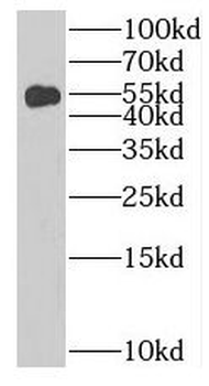 RRP8 Antibody
