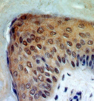 RRP8 Rabbit Polyclonal Antibody
