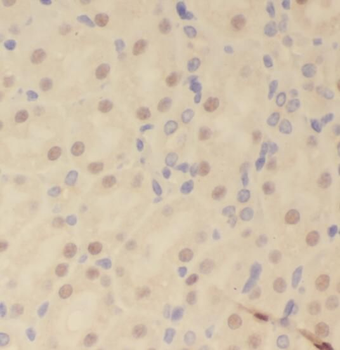 RPS6KA3 Rabbit Polyclonal Antibody