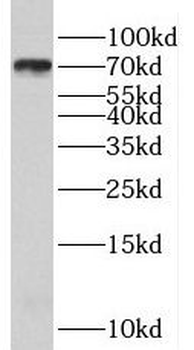 RSPH3 Antibody
