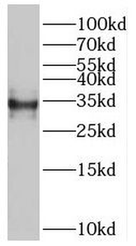 RSPH9 Antibody